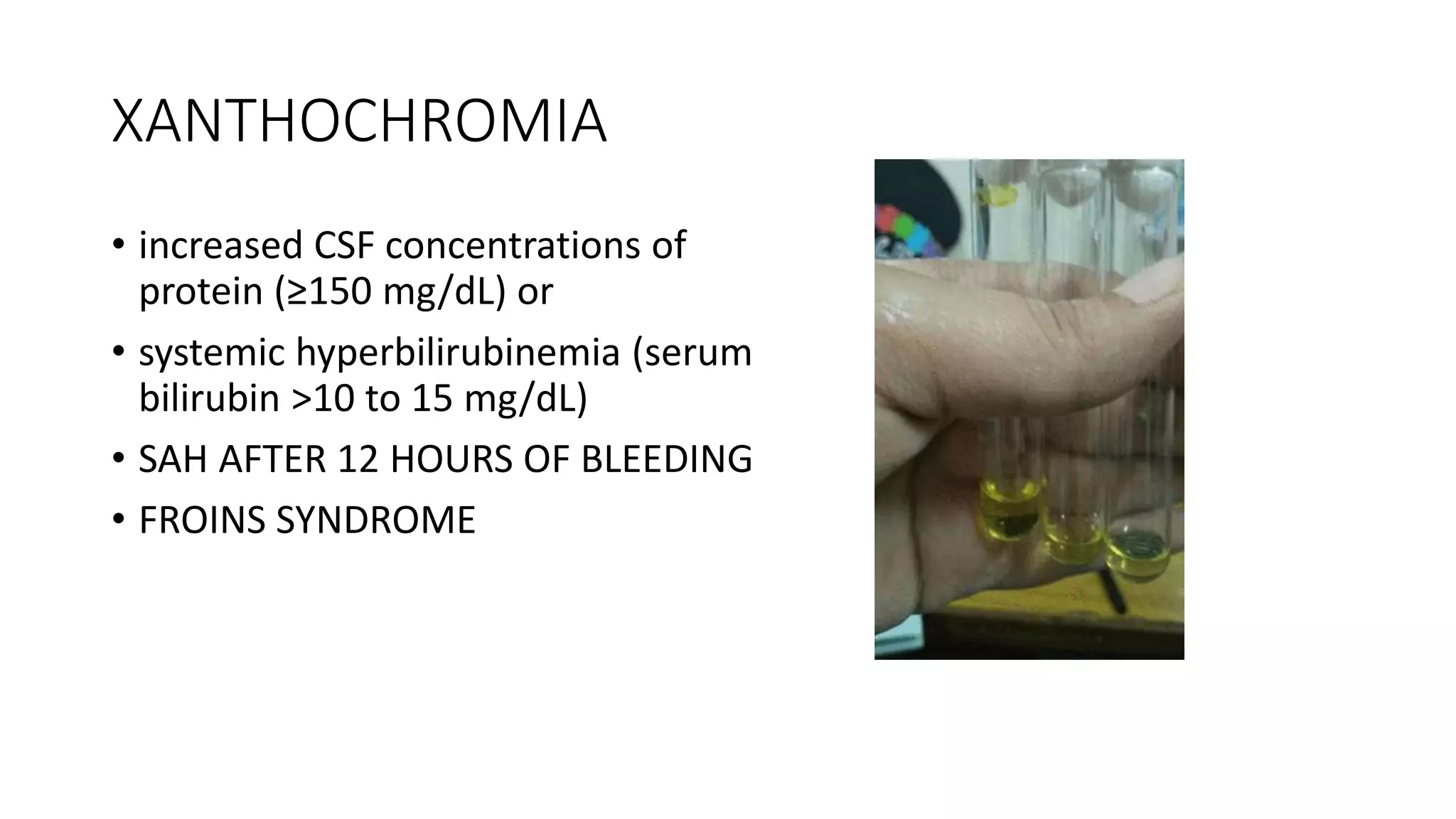XANTHOCHROMIA
• increased CSF concentrations of
protein (≥150 mg/dL) or
• systemic hyperbilirubinemia (serum
bilirubin >10 to 15 mg/dL)
• SAH AFTER 12 HOURS OF BLEEDING
• FROINS SYNDROME
 