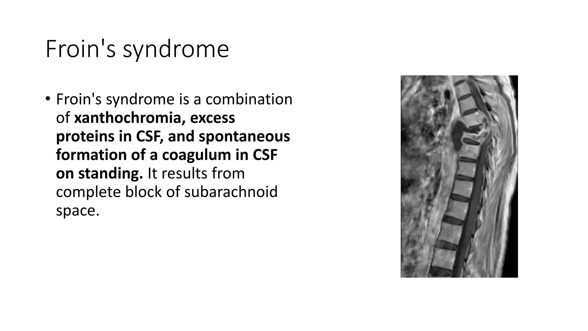 Froin's syndrome
• Froin's syndrome is a combination
of xanthochromia, excess
proteins in CSF, and spontaneous
formation of a coagulum in CSF
on standing. It results from
complete block of subarachnoid
space.
 