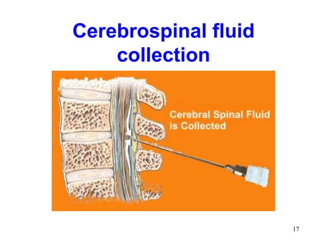 Cerebrospinal Fluid Blood Brain Barrier.ppt | Brain and Nervous System ...
