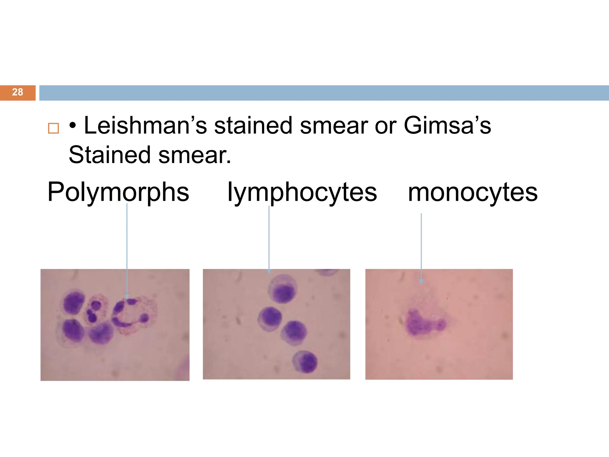 28
 • Leishman’s stained smear or Gimsa’s
Stained smear.
Polymorphs lymphocytes monocytes
 