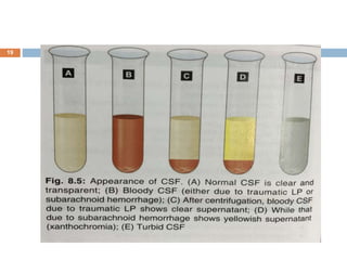 Csf Contamination CSF & Body Cavity Fluid Examination.ppt