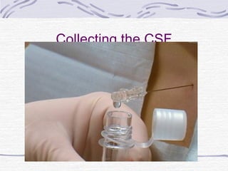 Collecting the CSF
 