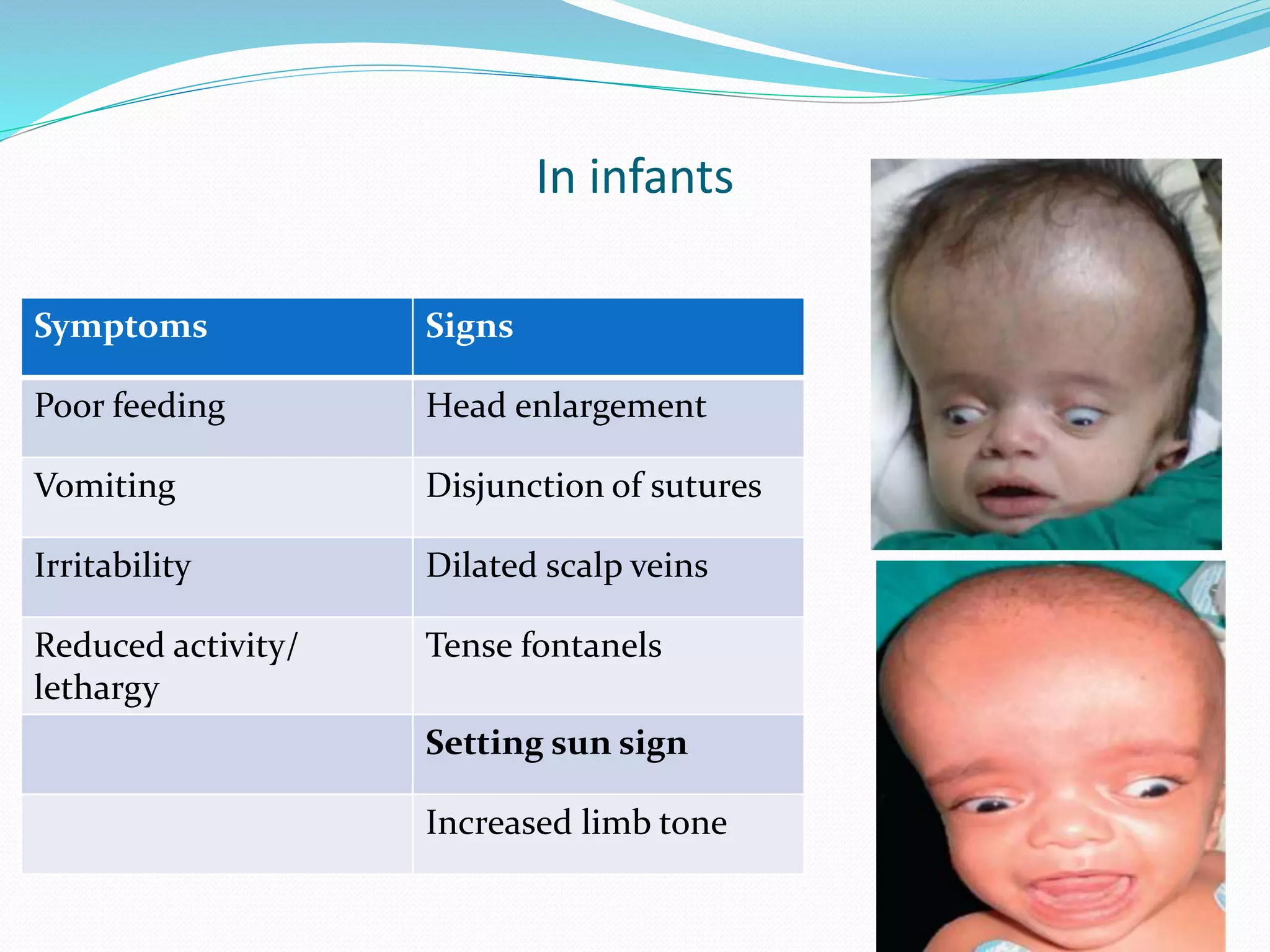 In infants
Symptoms Signs
Poor feeding Head enlargement
Vomiting Disjunction of sutures
Irritability Dilated scalp veins
Reduced activity/
lethargy
Tense fontanels
Setting sun sign
Increased limb tone
 