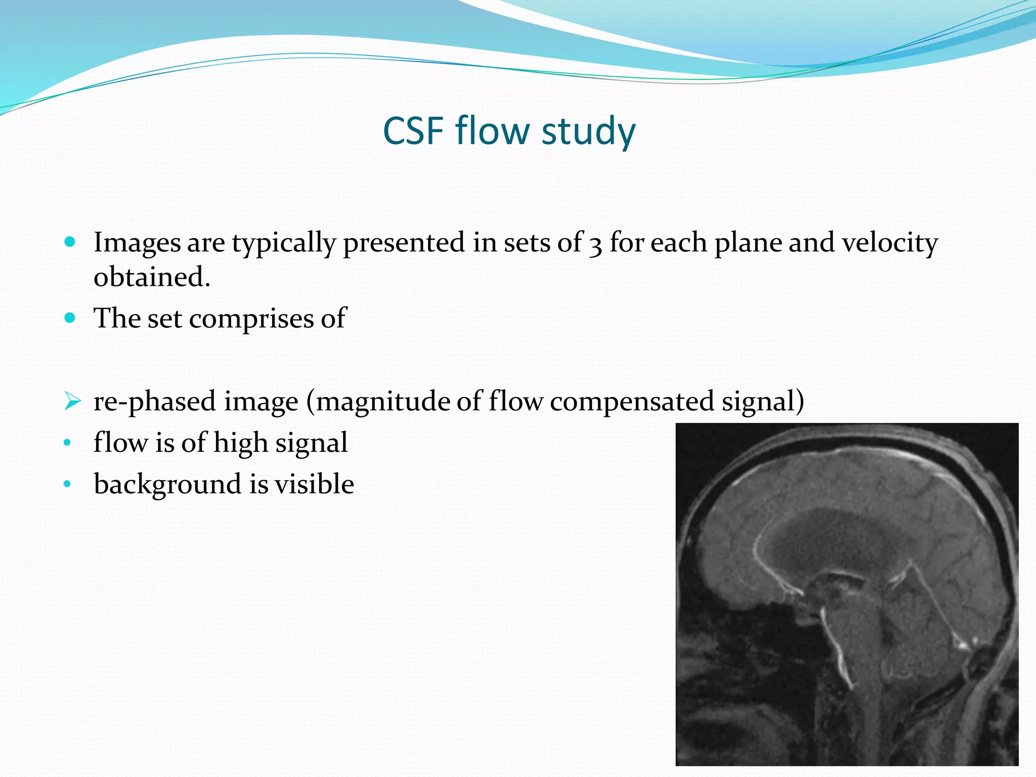 CSF flow study
 Images are typically presented in sets of 3 for each plane and velocity
obtained.
 The set comprises of
 re-phased image (magnitude of flow compensated signal)
• flow is of high signal
• background is visible
 