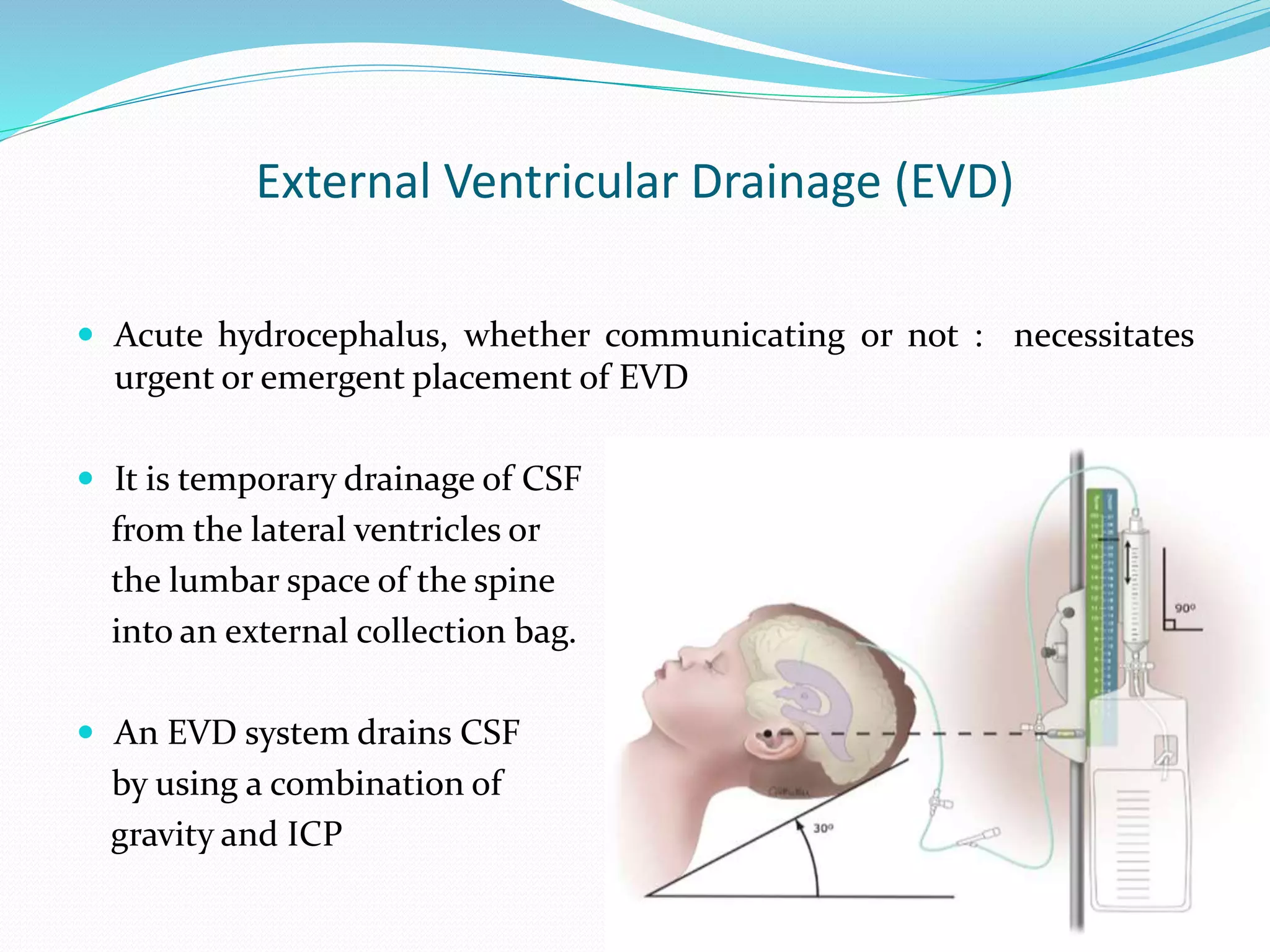 External Ventricular Drainage (EVD)
 Acute hydrocephalus, whether communicating or not : necessitates
urgent or emergent placement of EVD
 It is temporary drainage of CSF
from the lateral ventricles or
the lumbar space of the spine
into an external collection bag.
 An EVD system drains CSF
by using a combination of
gravity and ICP
 