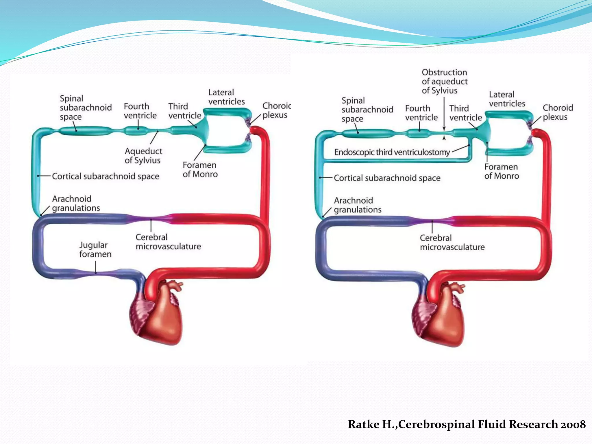 Ratke H.,Cerebrospinal Fluid Research 2008
 