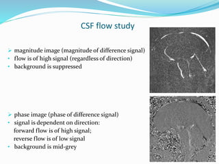 CSF flow study
 magnitude image (magnitude of difference signal)
• flow is of high signal (regardless of direction)
• background is suppressed
 phase image (phase of difference signal)
• signal is dependent on direction:
forward flow is of high signal;
reverse flow is of low signal
• background is mid-grey
 