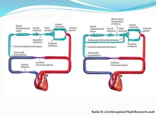Ratke H.,Cerebrospinal Fluid Research 2008
 
