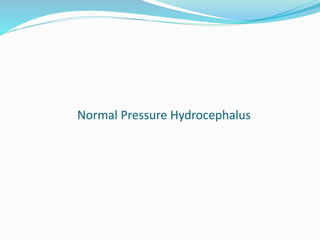 Normal Pressure Hydrocephalus
 
