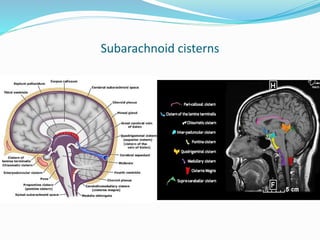 Subarachnoid cisterns
 