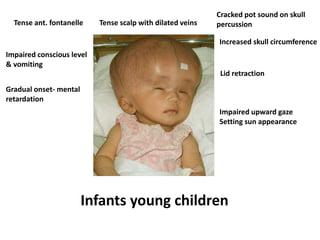 Tense ant. fontanelle
Impaired conscious level
& vomiting
Gradual onset- mental
retardation
Tense scalp with dilated veins
Cracked pot sound on skull
percussion
Increased skull circumference
Lid retraction
Impaired upward gaze
Setting sun appearance
Infants young children
 