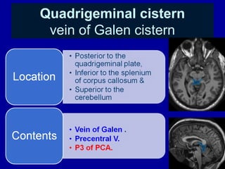 CSF cisterns | PPT