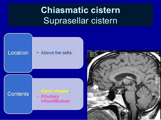 CSF cisterns