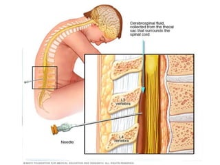 CSF examination | PPT