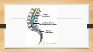 Lp Procedure Guide Comprehensive Guide to Lumbar Puncture: Procedure, Purpose, and Care | PPTX