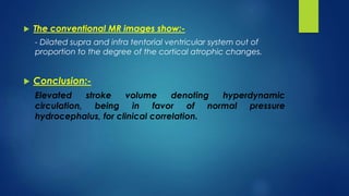  The conventional MR images show:-
- Dilated supra and infra tentorial ventricular system out of
proportion to the degree of the cortical atrophic changes.
 Conclusion:-
Elevated stroke volume denoting hyperdynamic
circulation, being in favor of normal pressure
hydrocephalus, for clinical correlation.
 
