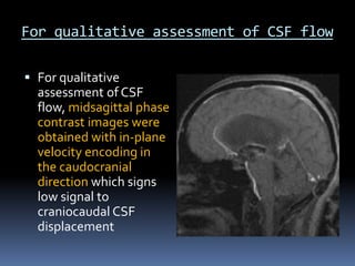 CSF flow study | PPT