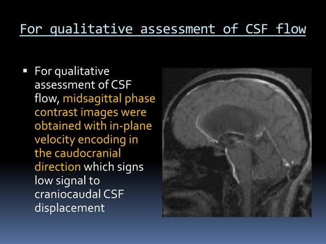 CSF flow study | PPT