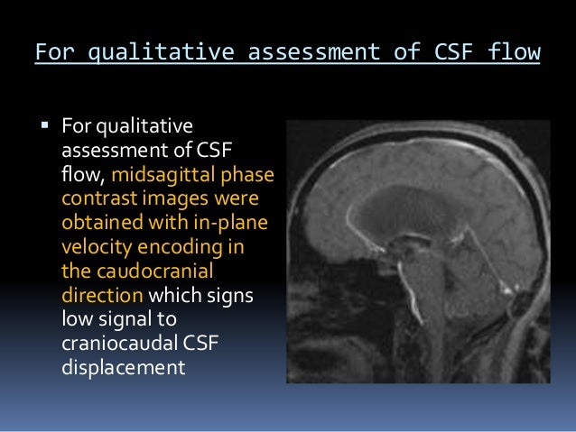 CSF flow study