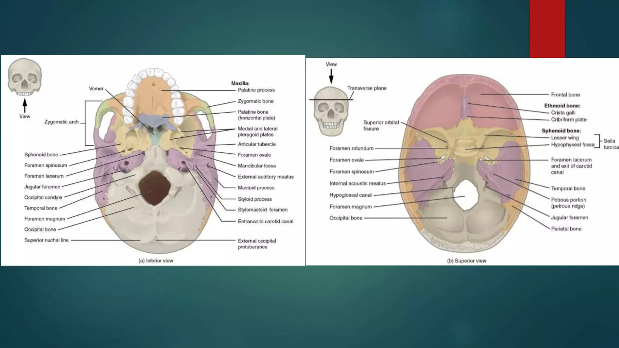 Csf Rhinorrhea - Overview | PPTX