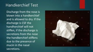 Handkerchief Test
Discharge from the nose is
blown into a handkerchief
and is allowed to dry. If the
discharge is CSF the
handherchief will not
stiffen, if the discharge is
secretions from the nose
the handkerchief stiffens
due to the presence of
mucin in the nasal
secretions.
 