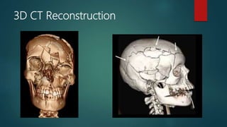 3D CT Reconstruction
 