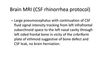 cerebrospinal fluid leak (CSF leak) | PPTX