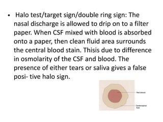 • Halo test/target sign/double ring sign: The
nasal discharge is allowed to drip on to a filter
paper. When CSF mixed with blood is absorbed
onto a paper, then clean fluid area surrounds
the central blood stain. Thisis due to difference
in osmolarity of the CSF and blood. The
presence of either tears or saliva gives a false
posi- tive halo sign.
 