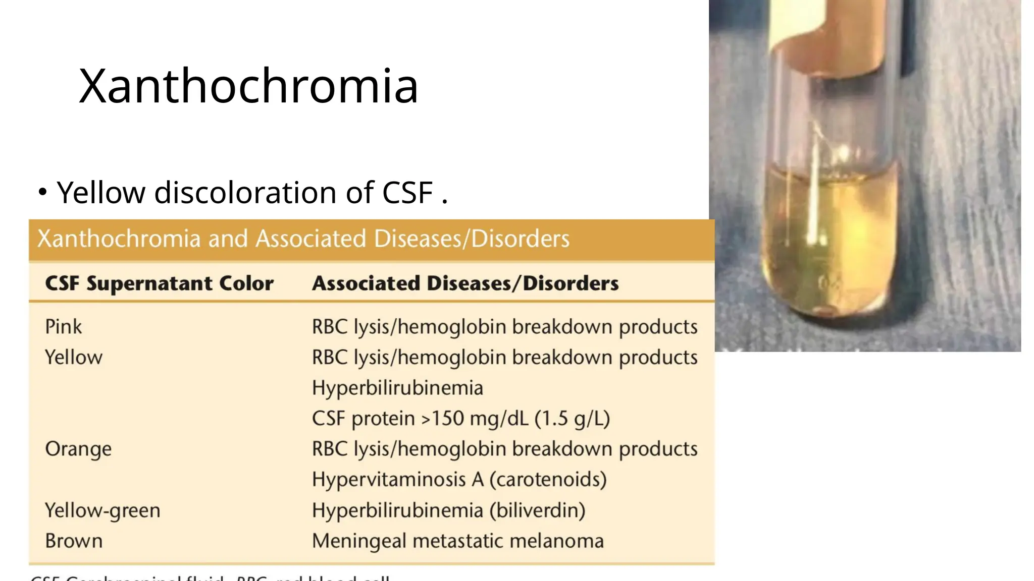 Xanthochromia
• Yellow discoloration of CSF .
 