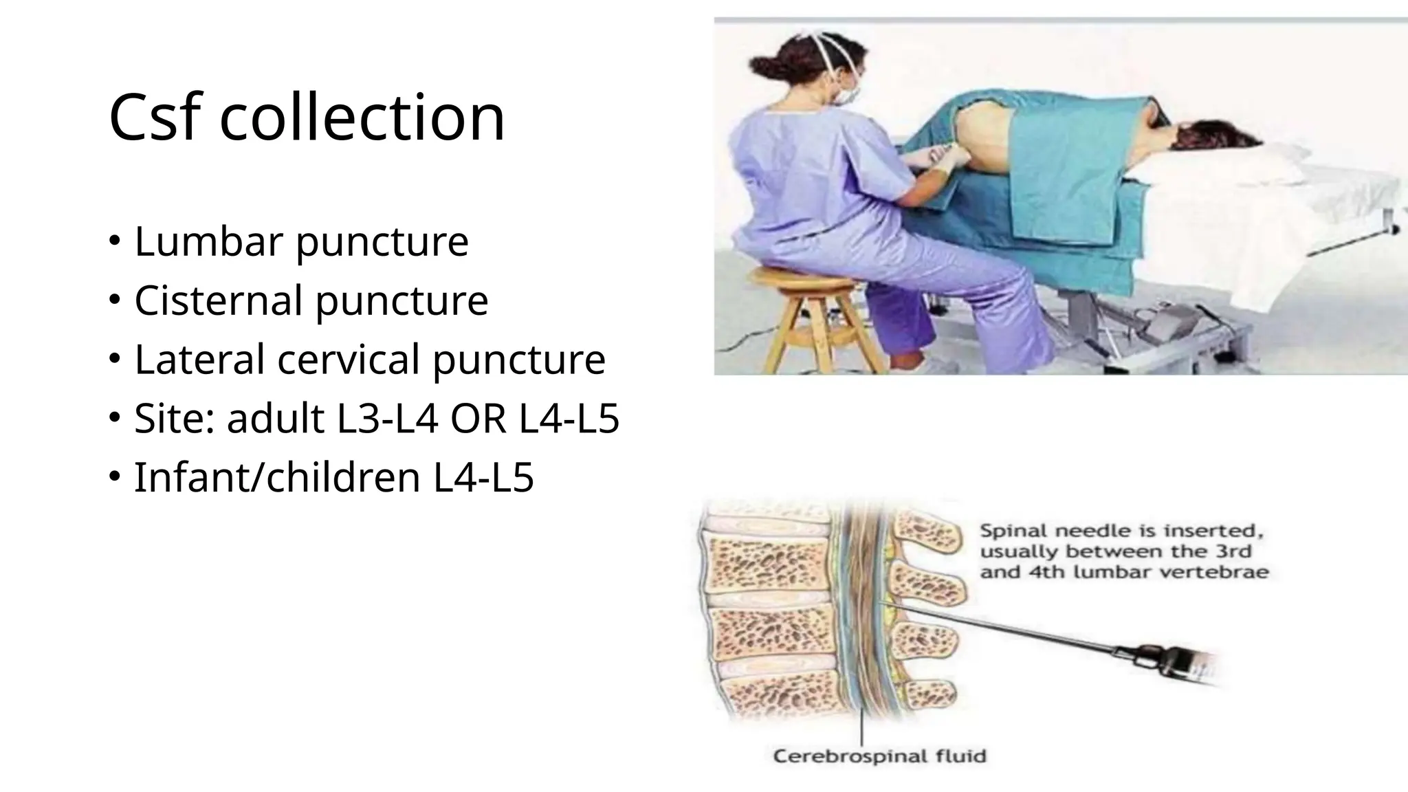 Csf collection
• Lumbar puncture
• Cisternal puncture
• Lateral cervical puncture
• Site: adult L3-L4 OR L4-L5
• Infant/children L4-L5
 