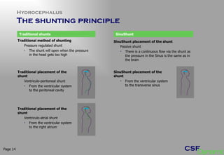 Hydrocephalus The shunting principle Page  Traditional method of shunting Pressure regulated shunt The shunt will open when the pressure in the head gets too high Traditional placement of the shunt Ventriculo-peritoneal shunt From the ventricular system to the peritoneal cavity SinuShunt placement of the shunt Passive shunt There is a continuous flow via the shunt as the pressure in the Sinus is the same as in the brain  Traditional placement of the shunt Ventriculo-atrial shunt From the ventricular system to the right atrium SinuShunt Traditional shunts SinuShunt placement of the shunt From the ventricular system to the transverse sinus 