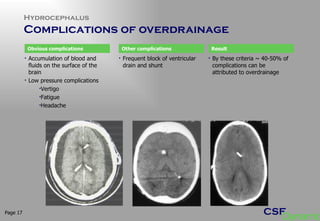 Hydrocephalus Complications of overdrainage  Page  Accumulation of blood and fluids on the surface of the brain Low pressure complications Vertigo Fatigue Headache Obvious complications Frequent block of ventricular drain and shunt Other complications By these criteria ~ 40-50% of complications can be attributed to overdrainage Result 