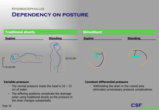 Hydrocephalus Dependency on posture Page  Variable pressure The normal pressure inside the head is 10 – 15 cm of water The differing positions complicate the drainage when using traditional shunts as the pressure in the drain changes substantially Traditional shunts ShinuShunt 55-75 CM Supine Standing Supine Standing Constant differential pressure Withholding the drain in the cranial area eliminates unnecessary pressure complications  0-10 CM 