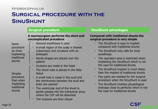 Hydrocephalus Surgical procedure with the  SinuShunt  Page  A neurosurgeon performs the short and uncomplicated procedure General anesthesia is used A small region of the scalp is shaved (cleanness) and scrubbed with an antiseptic Sterile drapes are placed over the patient Incisions are made in the head  The shunt tube is placed in the fatty tissue A small hole is made in the scull and the membranes between the scull and brain are opened The ventricular end of the shunt is gently passed into the transverse sinus where the CSF will be absorbed The incisions are then closed Surgical procedure SinuShunt advantages Compared with traditional shunts the surgical procedure is very simple The SinuShunt is easy to implant compared with traditional shunts  The SinuShunt only calls for local anesthesia The operation area is restricted when implanting the SinuShunt which is not the case for traditional shunts The SinuShunt implant is much faster than the implant of traditional shunts  Few parts are needed for the surgical procedure when the SinuShunt is used The SinuShunt imitates physiological drainage close to perfectly which is not the case for traditional shunts Same procedure as when implanting traditional shunts Simpler procedure than when implanting traditional shunts 