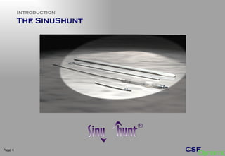 Introduction The SinuShunt  Page  