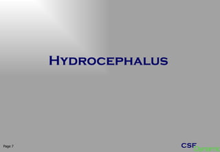 Hydrocephalus Page  