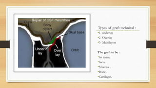Types of graft technical :
•1- underlay
•2- Overlay
•3- Multilayers
The graft to be :
•fat tissue.
•facia .
•Mucosa .
•Bone .
•Cartilages.
 