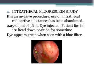4. INTRATHECAL FLUORESCEIN STUDY
It is an invasive procedure, use of intrathecal
radioactive substances has been abandoned.
0.25-0.5ml of 5% fl. Dye injected. Patient lies in
10◦ head down position for sometime.
Dye appears green when seen with a blue filter.
 