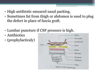 • High antibiotic smeared nasal packing.
• Sometimes fat from thigh or abdomen is used to plug
the defect in place of fascia graft.
• Lumbar puncture if CSF pressure is high.
• Antibiotics
• (prophylacticaly)
 