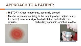 APPROACH TO A PATIENT:
 HISTORY: Clear rhinorrhoea, posturally evoked
 May be increased on rising in the morning when patient bends
his head ( reservoir sign: fluid which had collected in the
sinuses, particularly sphenoid, empties into the
nose).
 