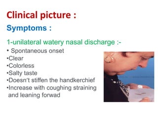 CSF Rhinorrhoea.ppsx