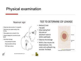 CSF RHINORRHOEA and management of csf rhinorrhea | PPTX