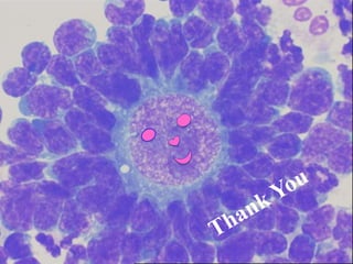 Fluid cytology in CSF