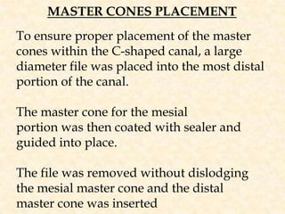 MASTER CONES PLACEMENTTo ensure proper placement of the master cones within the C-shaped canal, a large diameter file was placed into the most distal portion of the canal.The master cone for the mesialportion was then coated with sealer and guided into place.The file was removed without dislodging the mesial master cone and the distal master cone was inserted