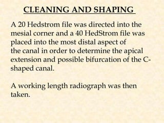 CLEANING AND SHAPING A 20 Hedstrom file was directed into the mesial corner and a 40 HedStrom file was placed into the most distal aspect ofthe canal in order to determine the apical extension and possible bifurcation of the C-shaped canal.A working length radiograph was then taken. 