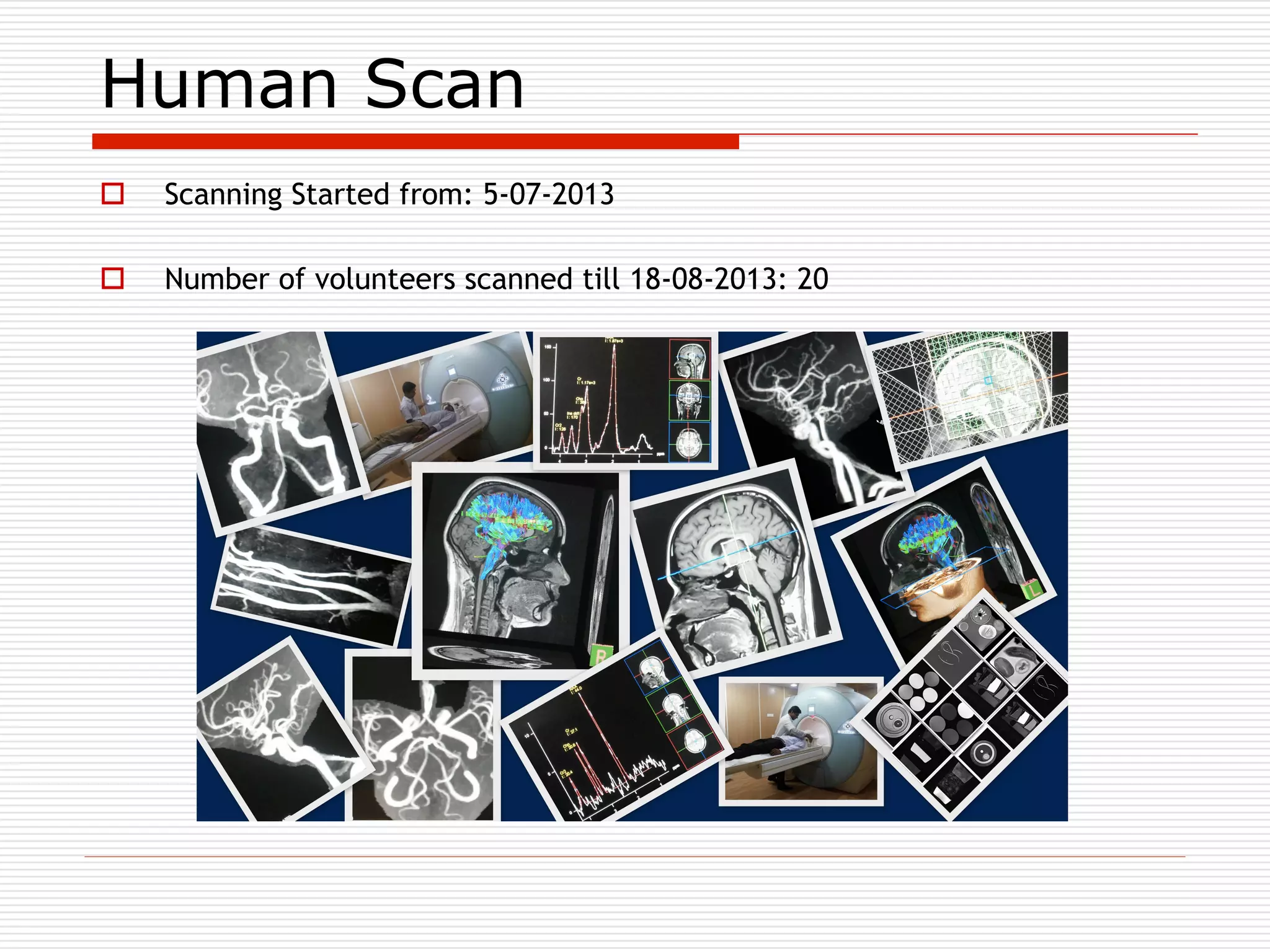 Introduction to compressed sensing MRI | PDF