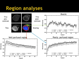 Introduction to compressed sensing MRI | PDF