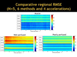 Introduction to compressed sensing MRI | PDF