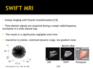 Introduction to compressed sensing MRI | PDF
