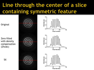 Introduction to compressed sensing MRI | PDF